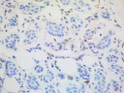 ALX4 antibody immunohistochemistry human breast tissue STJA0033362