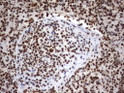 MLF1 antibody immunohistochemistry human lymph node tissue STJA0033377