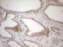 PD-L2 antibody immunohistochemistry human prostate tissue STJA0033387