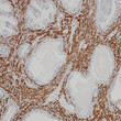 Desmin antibody immunohistochemistry paraffin-embedded prostate tissue STJA0033393