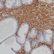 alpha smooth muscle actin antibody immunohistochemistry prostate STJA0033395