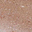 Neurofilament antibody immunohistochemistry brain paraffin-embedded STJA0033411