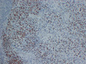 Myogenin antibody immunohistochemistry rhabdomyosarcoma paraffin-embedded tissue STJA0033417