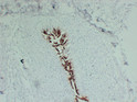 Uroplakin 3A antibody immunohistochemistry bladder tissue STJA0033418