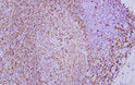 CD74 antibody immunohistochemistry paraffin-embedded tonsil tissue STJA0033421