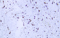 NAPSIN A antibody immunohistochemistry human lung STJA0033423