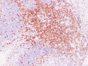 CD5 antibody immunohistochemistry paraffin-embedded tonsil STJA0033431