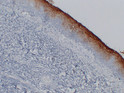 CEA antibody immunohistochemistry paraffin-embedded tonsil STJA0033434