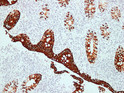 Cytokeratin 20 antibody immunohistochemistry Appendix paraffin-embedded tissue STJA0033437