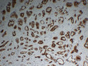 PSMA antibody immunohistochemistry prostate tissue STJA0033446