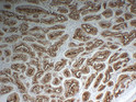 PSMA antibody immunohistochemistry paraffin-embedded prostate tissue STJA0033446