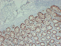 TGF beta Receptor I antibody immunohistochemistry colon tissue STJA0033448