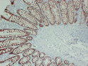 TGF beta Receptor I antibody immunohistochemistry colon tissue paraffin-embedded STJA0033448