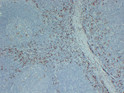 CD163 antibody immunohistochemistry paraffin-embedded tonsil tissue STJA0033453