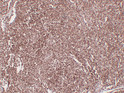 CD1a antibody immunohistochemistry thymoma tissue STJA0033454