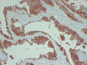 Cytokeratin 13 antibody immunohistochemistry transitional cell carcinoma STJA0033459