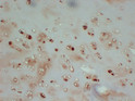 Collagen II alpha 1 antibody immunohistochemistry cartilage STJA0033463