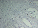 Mast Cell Tryptase antibody immunohistochemistry paraffin-embedded uterus STJA0033466