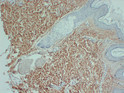 Collagen III alpha 1 antibody immunohistochemistry skin paraffin-embedded STJA0033514