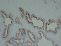 Prostatic Acid Phosphatase antibody immunohistochemistry human prostate STJA0033547