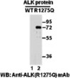 ALKR1275Q antibody western blot recombinant protein STJA0033556