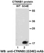 CTNNB1G34E antibody western blot recombinant protein STJA0033574