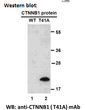 CTNNB1 T41A antibody western blot recombinant protein STJA0033578