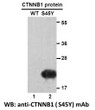 CTNNB1 S45Y antibody western blot recombinant protein STJA0033581
