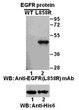 EGFRL858R antibody western blot recombinant protein STJA0033586
