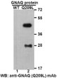 GNAQQ209L antibody western blot recombinant protein STJA0033610