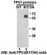 TP53R175H antibody western blot recombinant protein STJA0033674