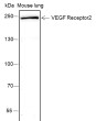 VEGF Receptor2 antibody western blot mouse lung STJA0033699
