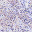 CD33 antibody immunohistochemistry human lymphoma STJA0033759