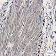 Isocitrate dehydrogenase antibody immunohistochemistry human cholangiocarcinoma STJA0033790