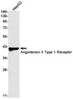 Angiotensin II Type 1 Receptor antibody western blot HepG2 STJA0033798