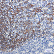 Cytokeratin 16 antibody immunohistochemistry human tonsil STJA0033851