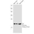 Ferritin Heavy Chain antibody western blot rat liver brain STJA0033935