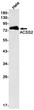 ACSS2 antibody western blot HeLa STJA0033975