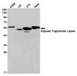 Adipose Triglyceride Lipase antibody western blot K562 C6 3T3 HeLa STJA0033984