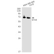 B7H4 antibody western blot MDA-MB-468 T47D STJA0034061