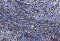 CD7 antibody immunohistochemistry human tonsil STJA0034146