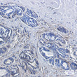 CD99 antibody immunohistochemistry human breast cancer STJA0034148