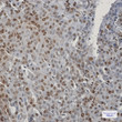 CIRBP antibody immunohistochemistry human breast cancer STJA0034175