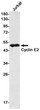 Cyclin E2 antibody western blot Jurkat STJA0034217