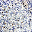 Cyclin E2 antibody immunohistochemistry human lung cancer STJA0034217