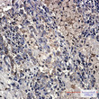 DcR2 antibody immunohistochemistry human lung cancer STJA0034239