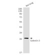 Galectin 3 antibody western blot rat lung STJA0034343