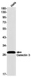 Galectin 3 antibody western blot HeLa lysates STJA0034345