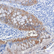 Galectin 3 antibody immunohistochemistry human colon cancer STJA0034345