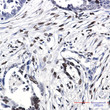 Histone H10 antibody immunohistochemistry human cholangiocarcinoma STJA0034409